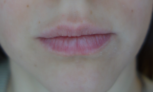 lips around line lip skin yellow green mouth blue below face these pink