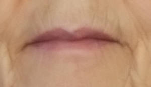 Normal color around lips